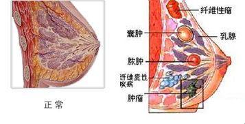 “游戏界奇谈：乳腺囊肿与老公吸奶之谜”